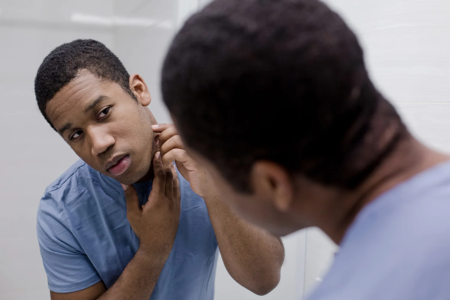 Bevel Code: Acne Scarring + The Road to Healing