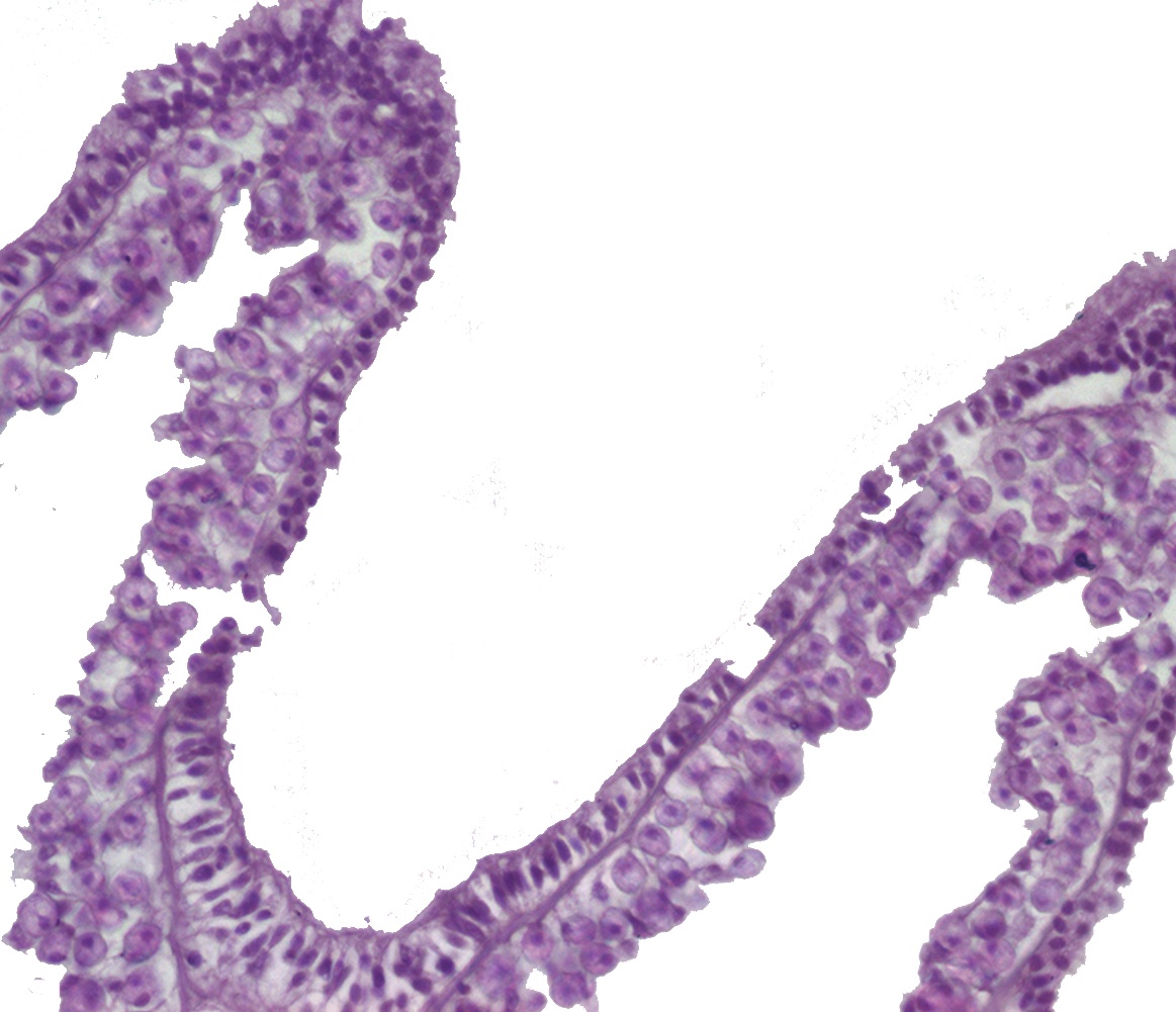  A portion of a  Seriatopora hystrix  polyp 