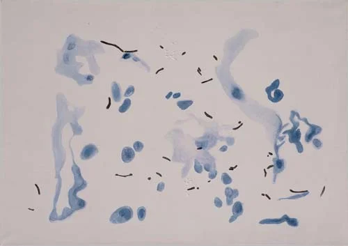 Virus IV., 1996-1997, akryl, plátno 95×125 cm