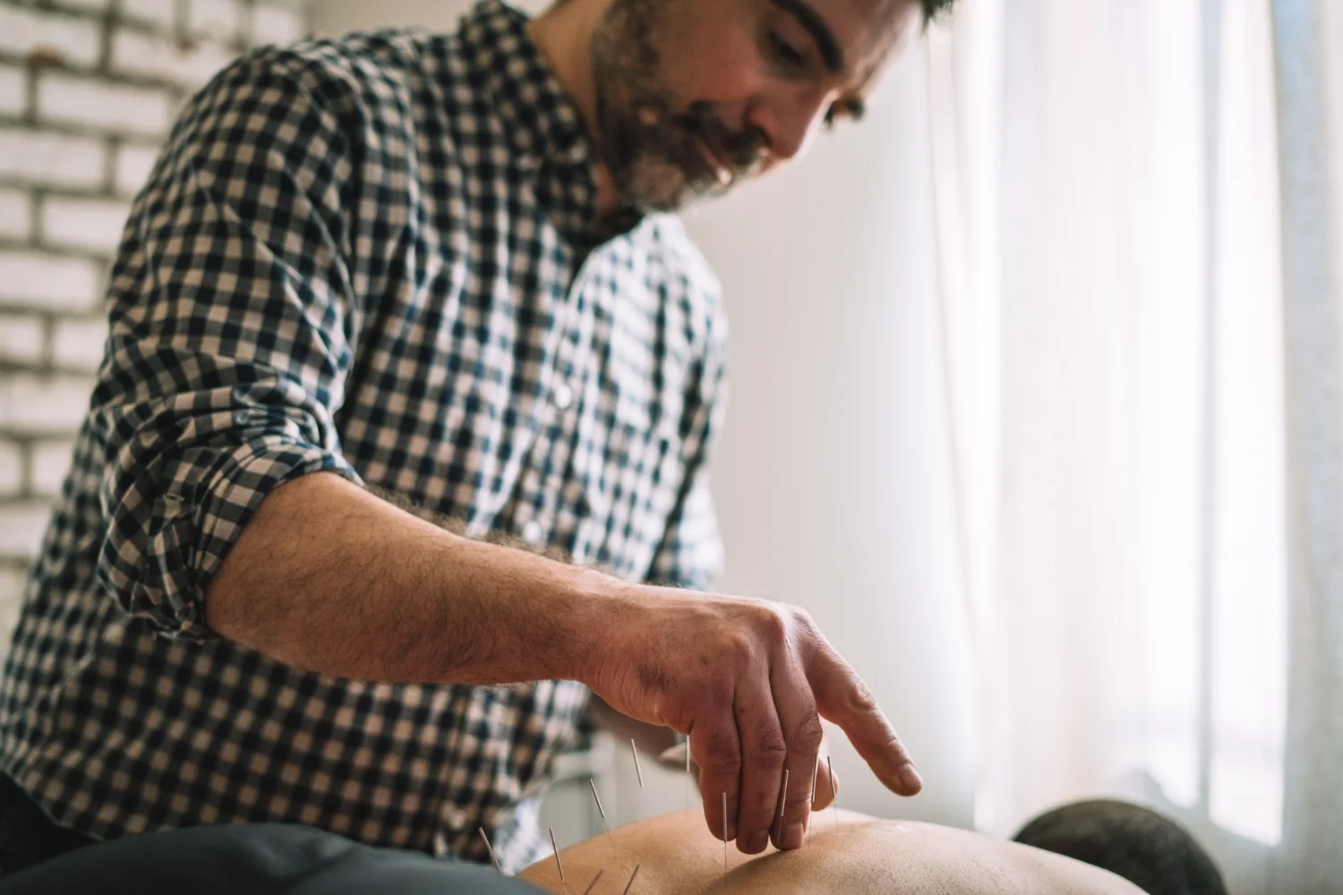 Relieving back pain with acupuncture.