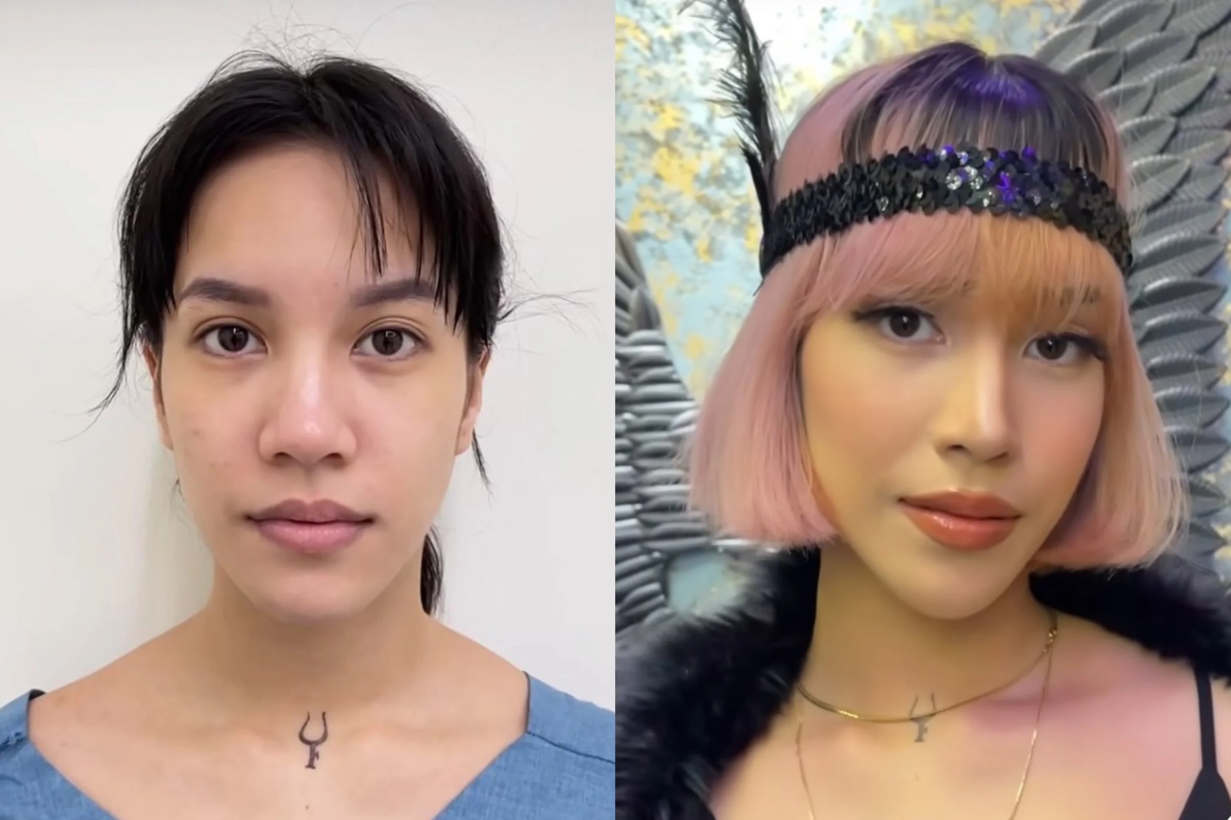 Here's Everything You Need To Know About Rhinoplasty