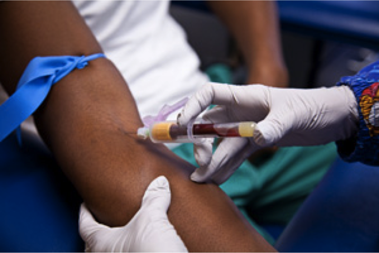 VENIPUNCTURE: PAINFUL AND UNCOMFORTABLE