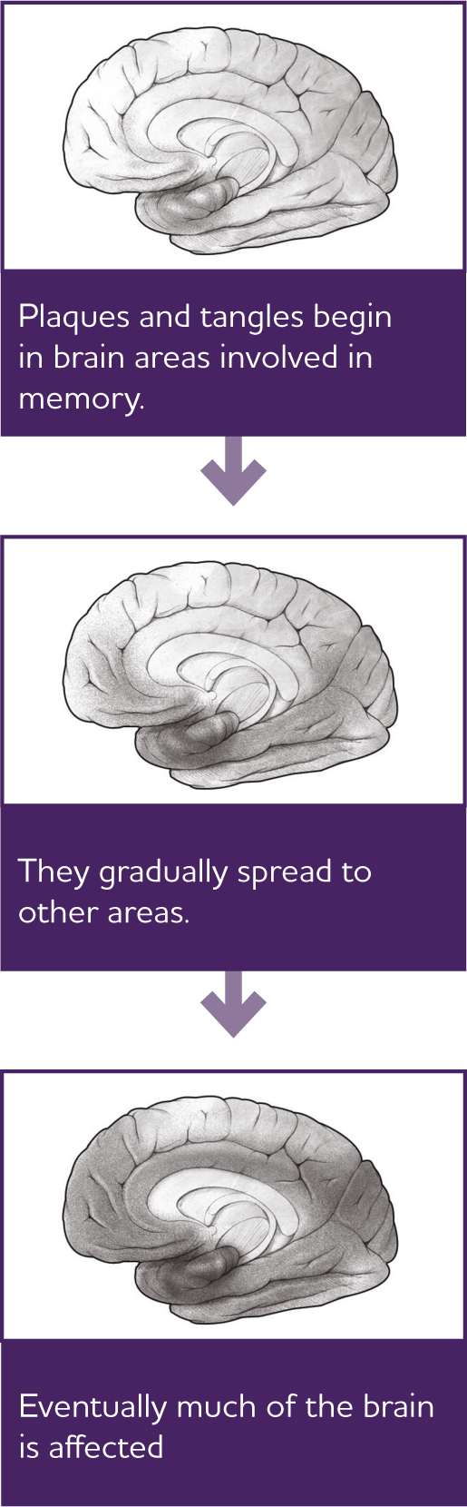 AffectingBrain.png