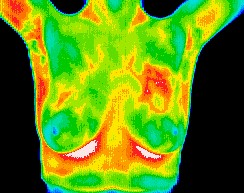 Thermal_Imaging.jpg