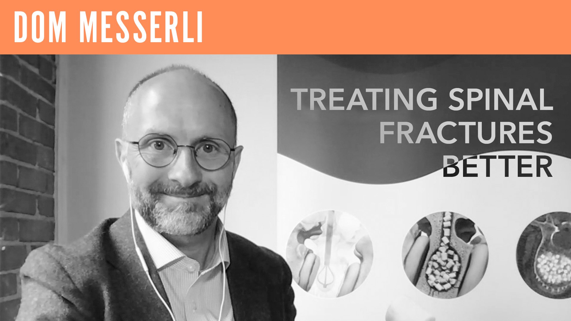 Dom Messerli, "Treating Spinal Fractures Better"