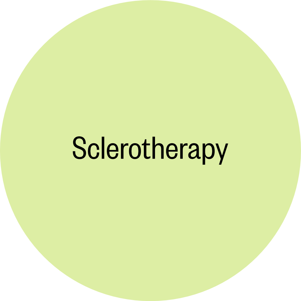 4_Sclerotherapy.png