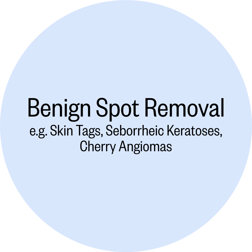 9_Benign Spot.png