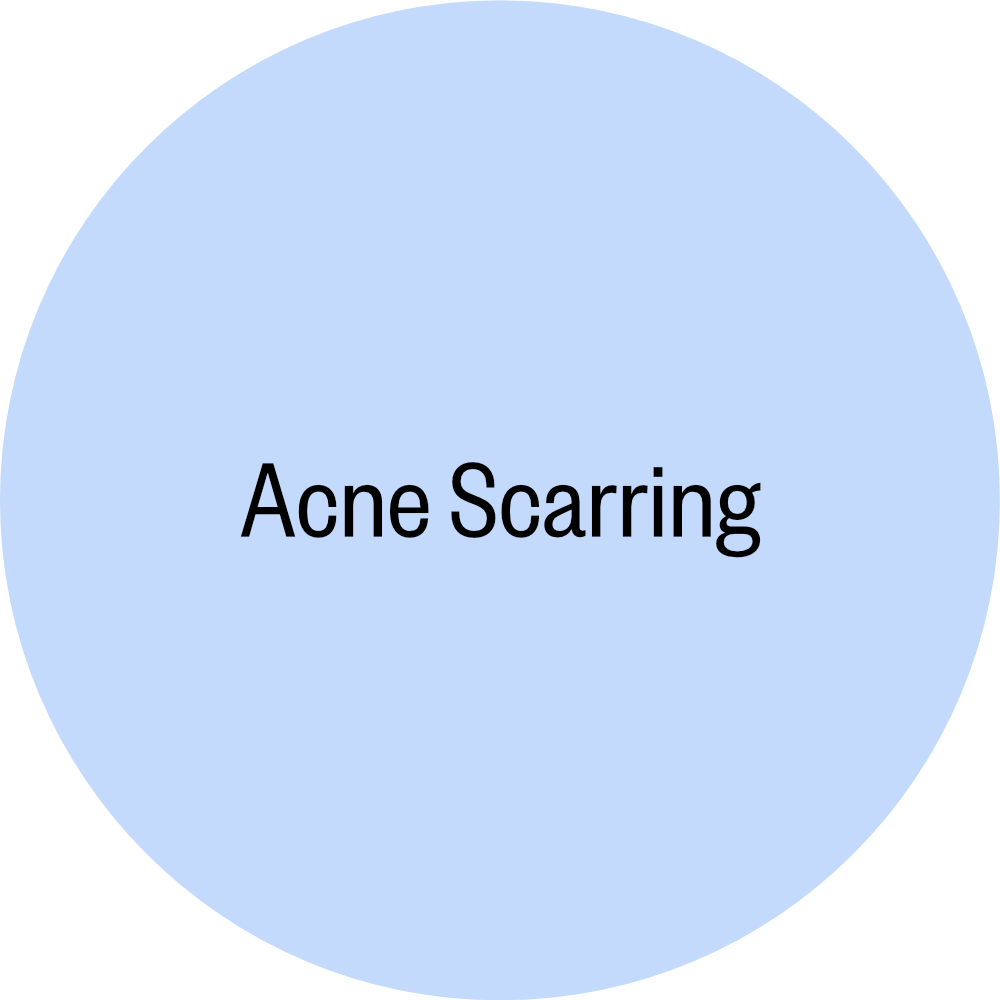 10_Acne Scarring.png