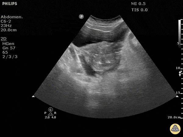 Https Encrypted Tbn0 Gstatic Com Images Q Tbn 3aand9gcrydupnv1hi7aqf3y4rtrk52cpzbmc4fjgtmw Usqp Cau