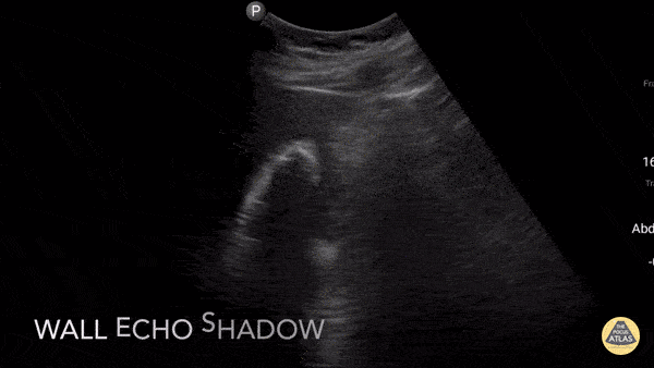 Wall Echo Shadow
