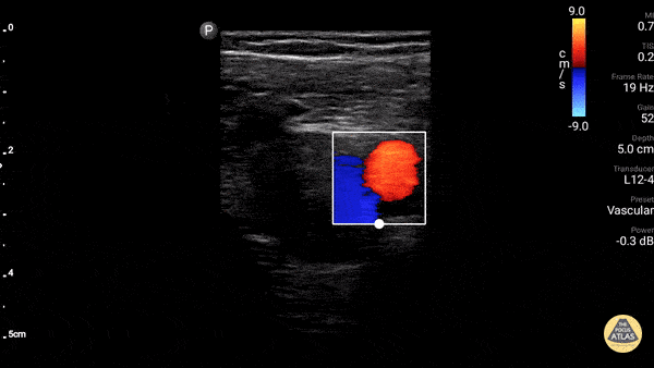 Great Saphenous Vein