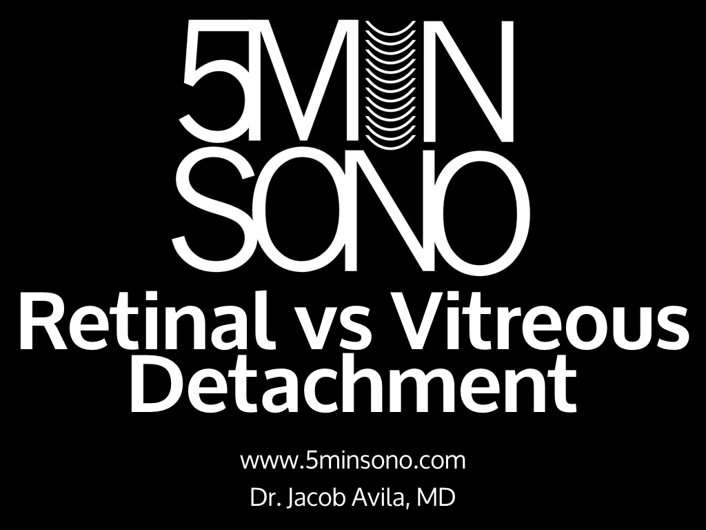 5-Min-Sono-RD-vs-VD-v2.020.jpg