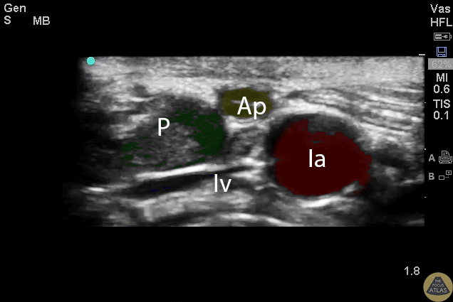 Labeled Colorized Appendix with Landmarks