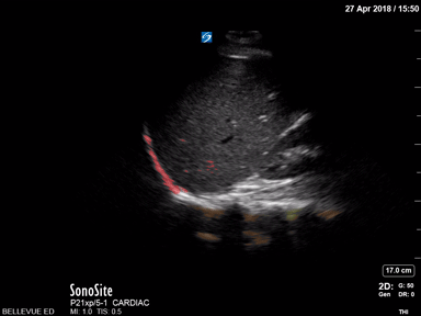 Pleural Space - Colorized