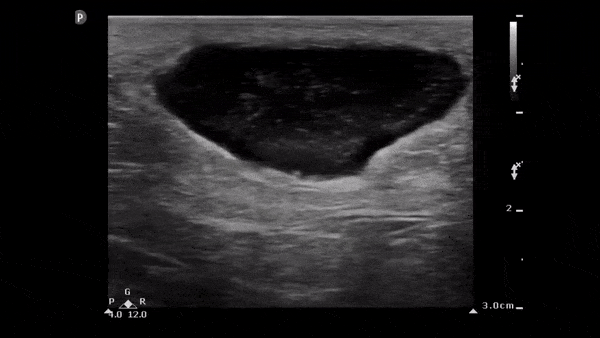 ezgif.com-optimize (3).gif