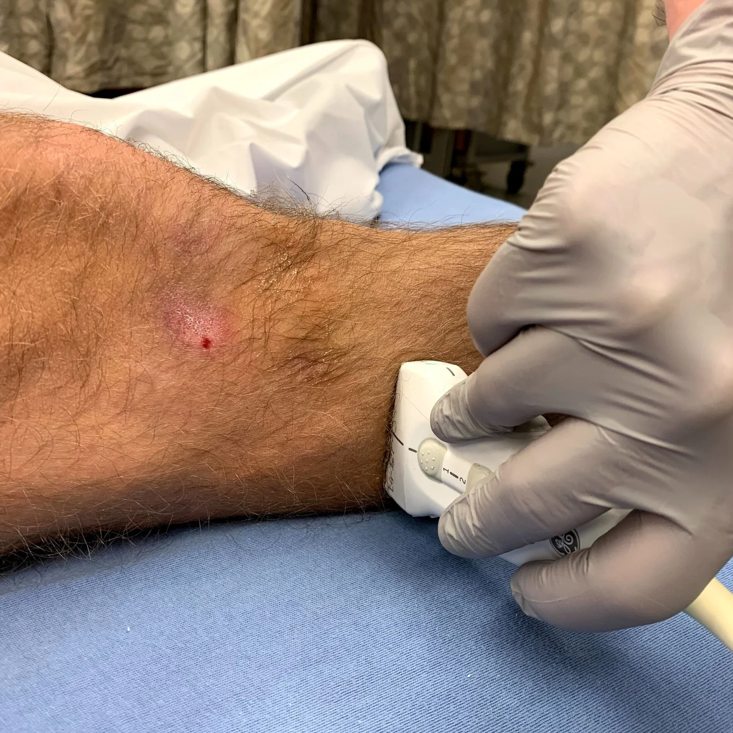 Lower Extremity Nerve Blocks Image Atlas — TPA