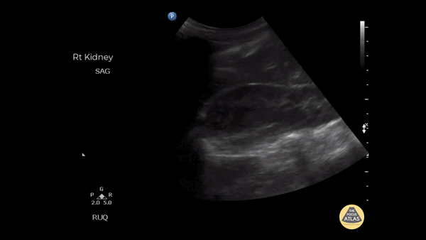 健康・医学 ATLAS OF Renal Ultrasonography O'NEILL Amazon.co.jp: Atlas of Renal Ultrasonography : O'Neill MD, W