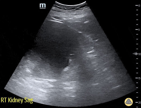 健康・医学 ATLAS OF Renal Ultrasonography O'NEILL ccr31934-toc-0001-m.jpg?trick=