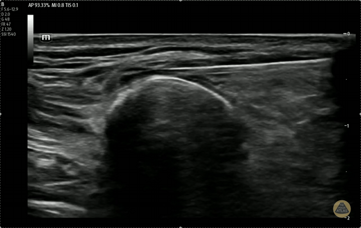 Clavipectoral