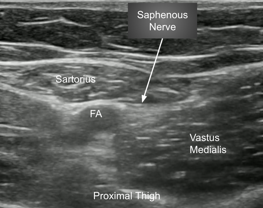 Saphenous-US-1.png