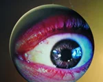 Eyes