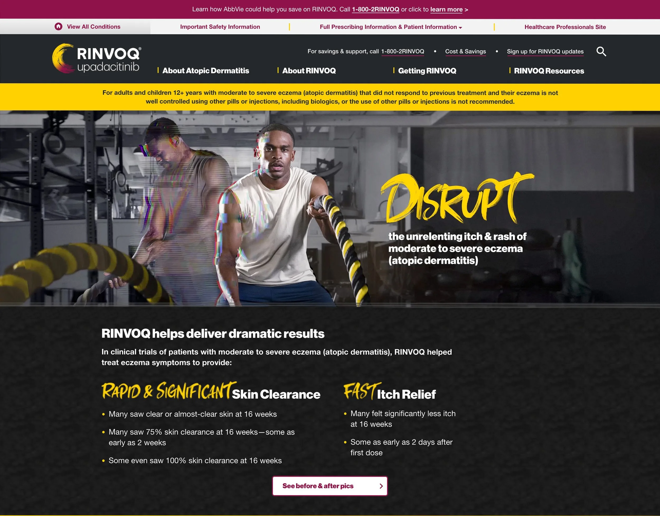 Rinvoq for AD Website