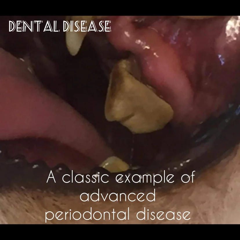 dental disease.jpg