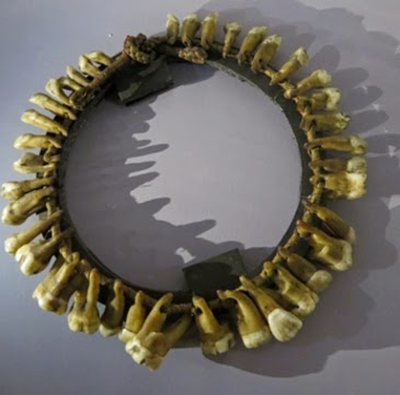 Necklace of human teeth brought back from the Congo region by H.M. Stanley, taken in a fight between his party and a cannibal tribe along the Ituri river in 1889. (Copyright: the Hunterian Museum at the Royal College of Surgeons, London.)