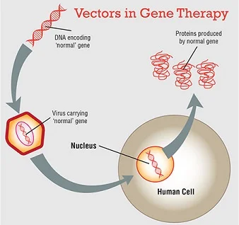 Image Credit: http://www.retina-specialist.com/article/gene-therapy-the-new-frontier-for-inherited-retinal-disease
