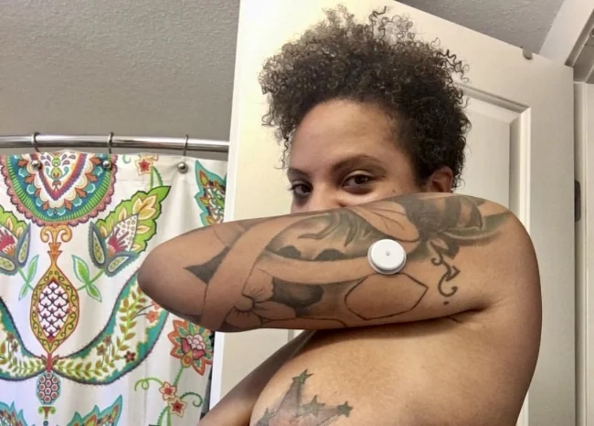 That is a blood sugar monitor in my arm. While it prompts lots of questions, it beats the alternative of having to stick myself with a needle in the fingers, three times a day. This only hurts a little if it snags on something or bumps up against something too hard. 