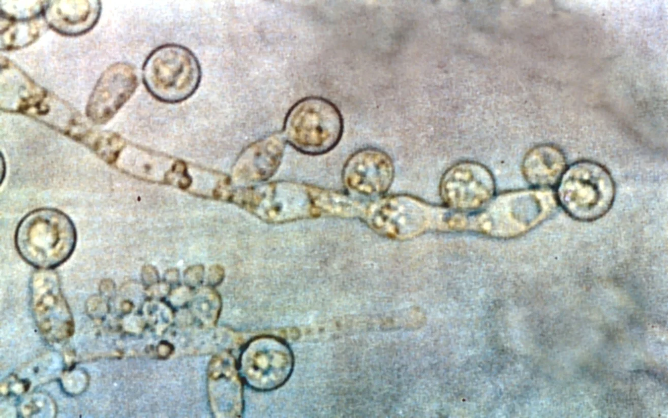 Candida_albicans.jpg