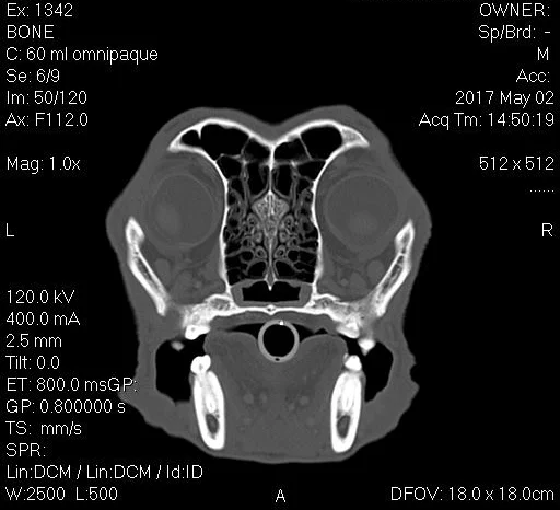 The nasal cavity is a very intricate region and excellent detail is needed to accurately evaluate patients for nasal disease. This is the scan of a Labrador retriever showing a normal nasal cavity. The intricate scroll-like structures seen in the center of the scan are the turbinate bones.