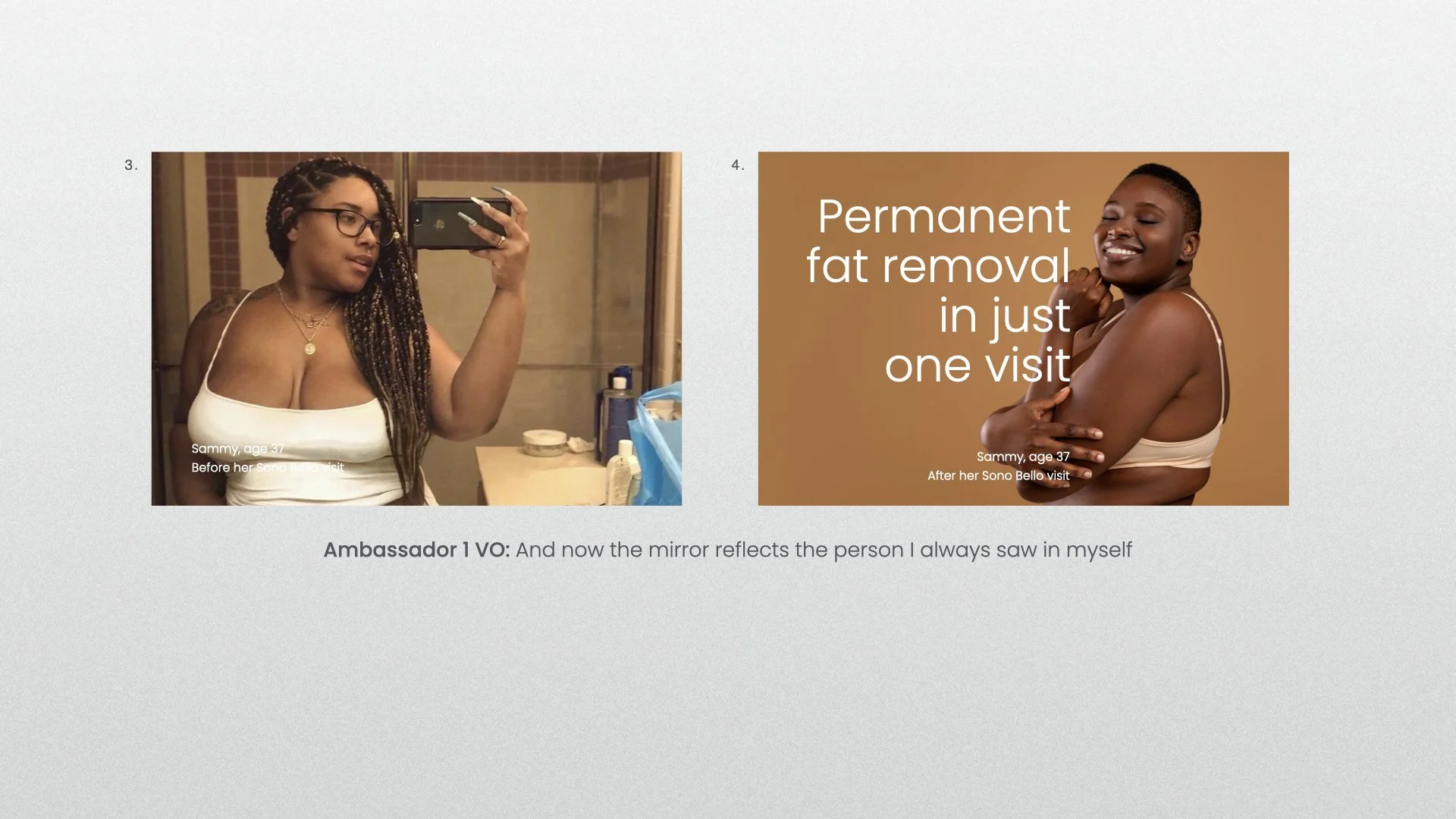 Sono Bello TVS concept BYB_JW V3.009.jpeg