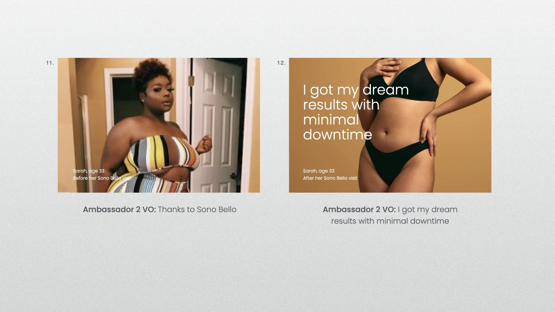 Sono Bello TVS concept BYB_JW V3.013.jpeg