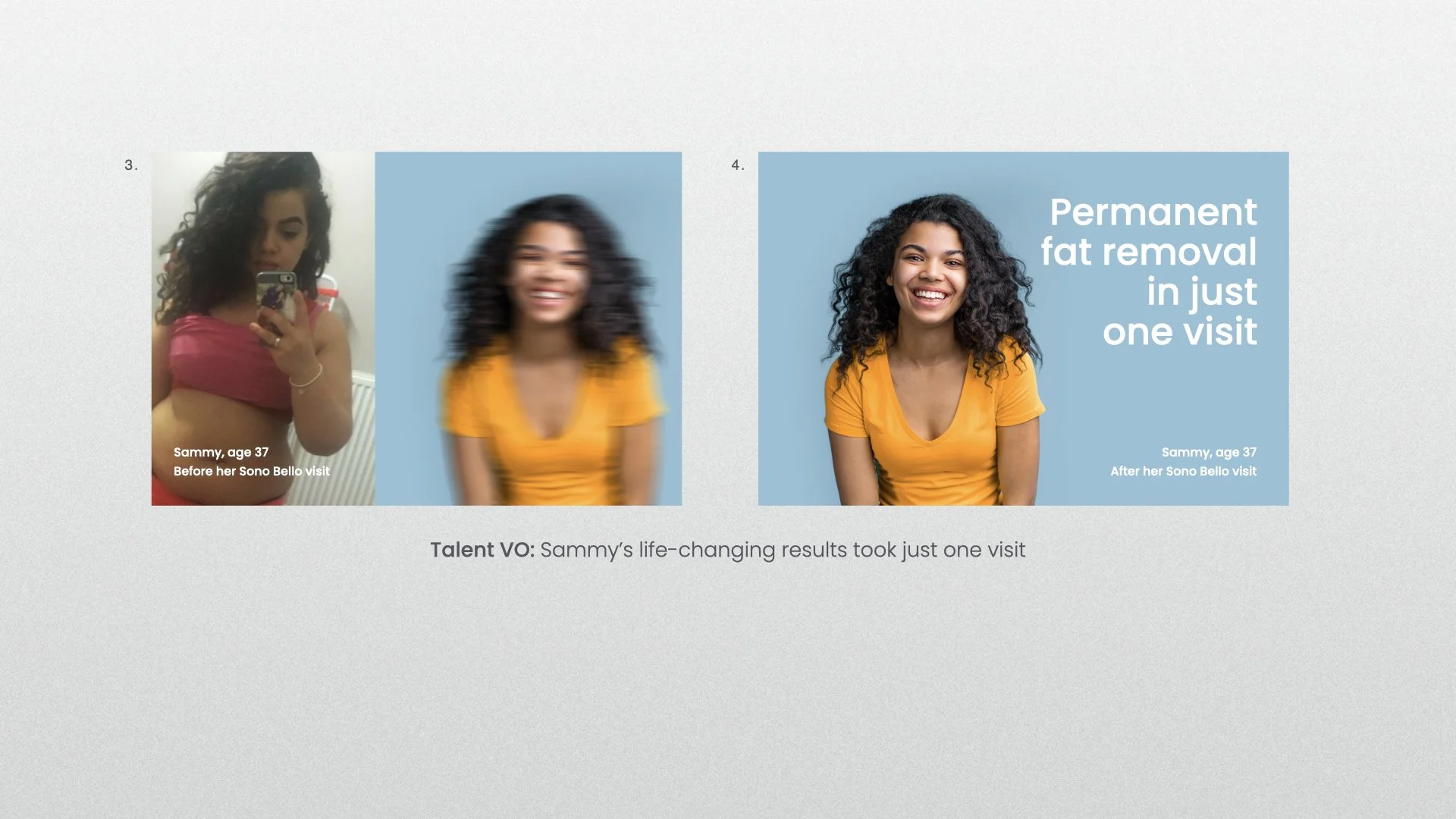 Sono Bello TVS concept BYB_JW V3 2.009.jpeg