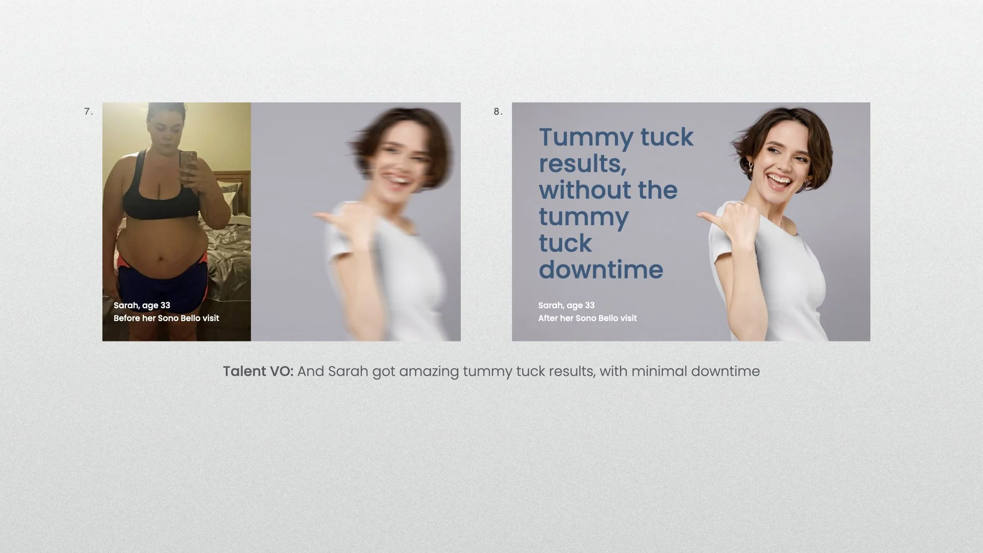 Sono Bello TVS concept BYB_JW V3 2.010.jpeg