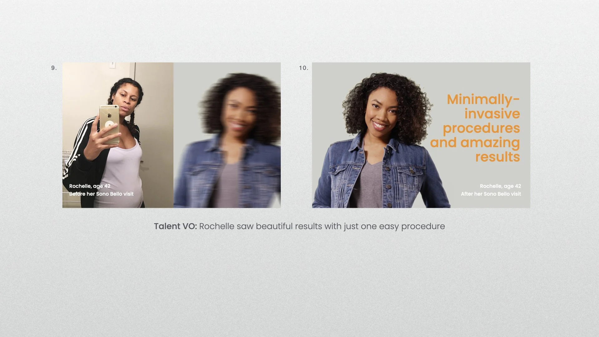 Sono Bello TVS concept BYB_JW V3 2.014.jpeg