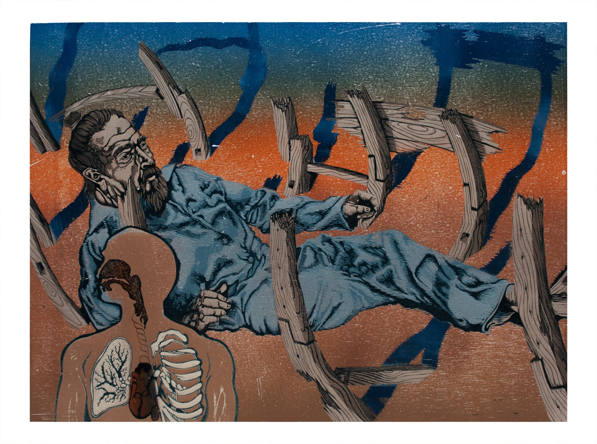 Fentanyl Dreams, RFallonMcG copy.JPG