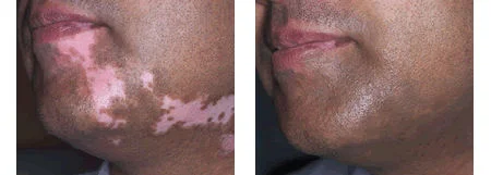skincamouflage6.jpg