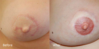 nipple.jpg