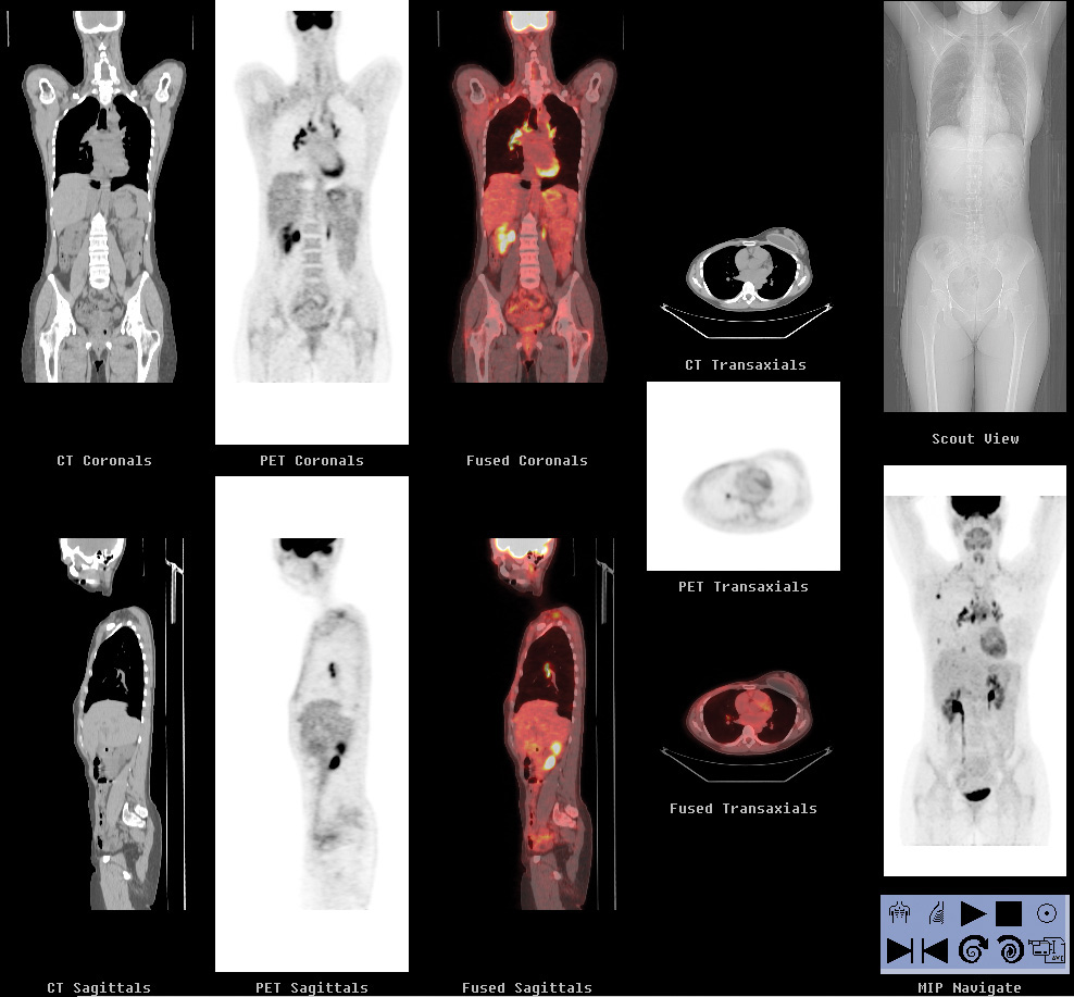 Cardiac computed tomography (Copy)