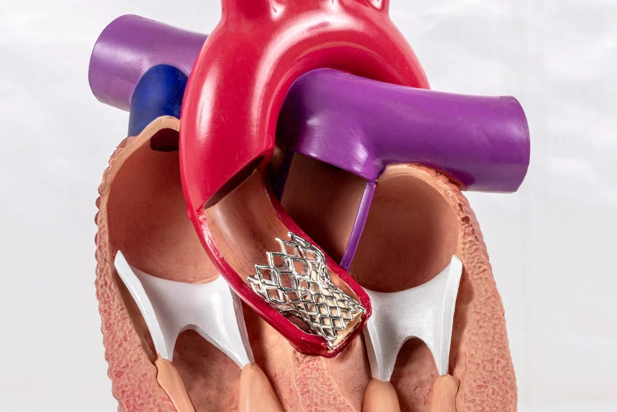 TAVR: A Less Invasive Option for Treating Severe Aortic Stenosis