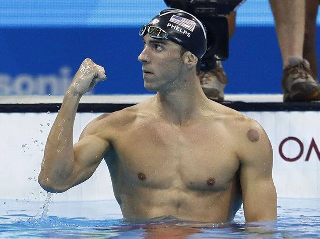 Archaic and effective: Myofascial Cupping Therapy