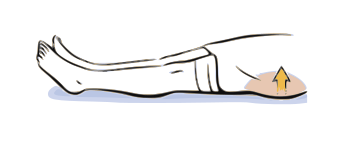 The object with this exercise is to tighten your buttocks without feeling any tightness develop in your hamstring or back muscles. The hamstrings are the muscles in the back of your thigh. Hold for 5 seconds and perform 20 repetitions. 