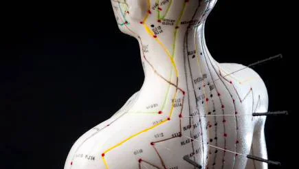 Acupuncture