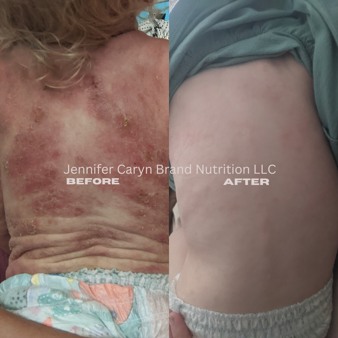 Before and afters START WITH THESE (15).png