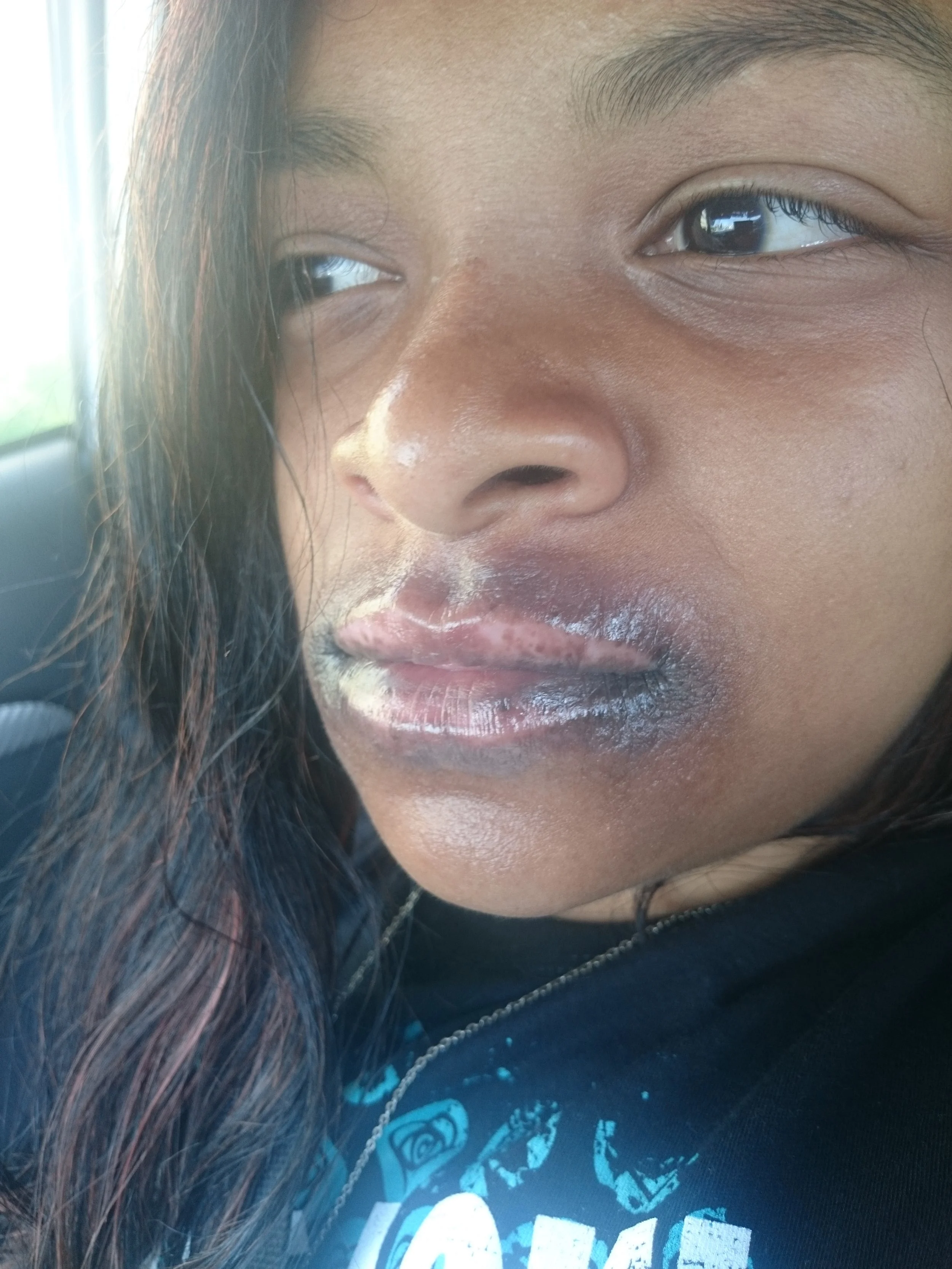 Kelsey before treatment