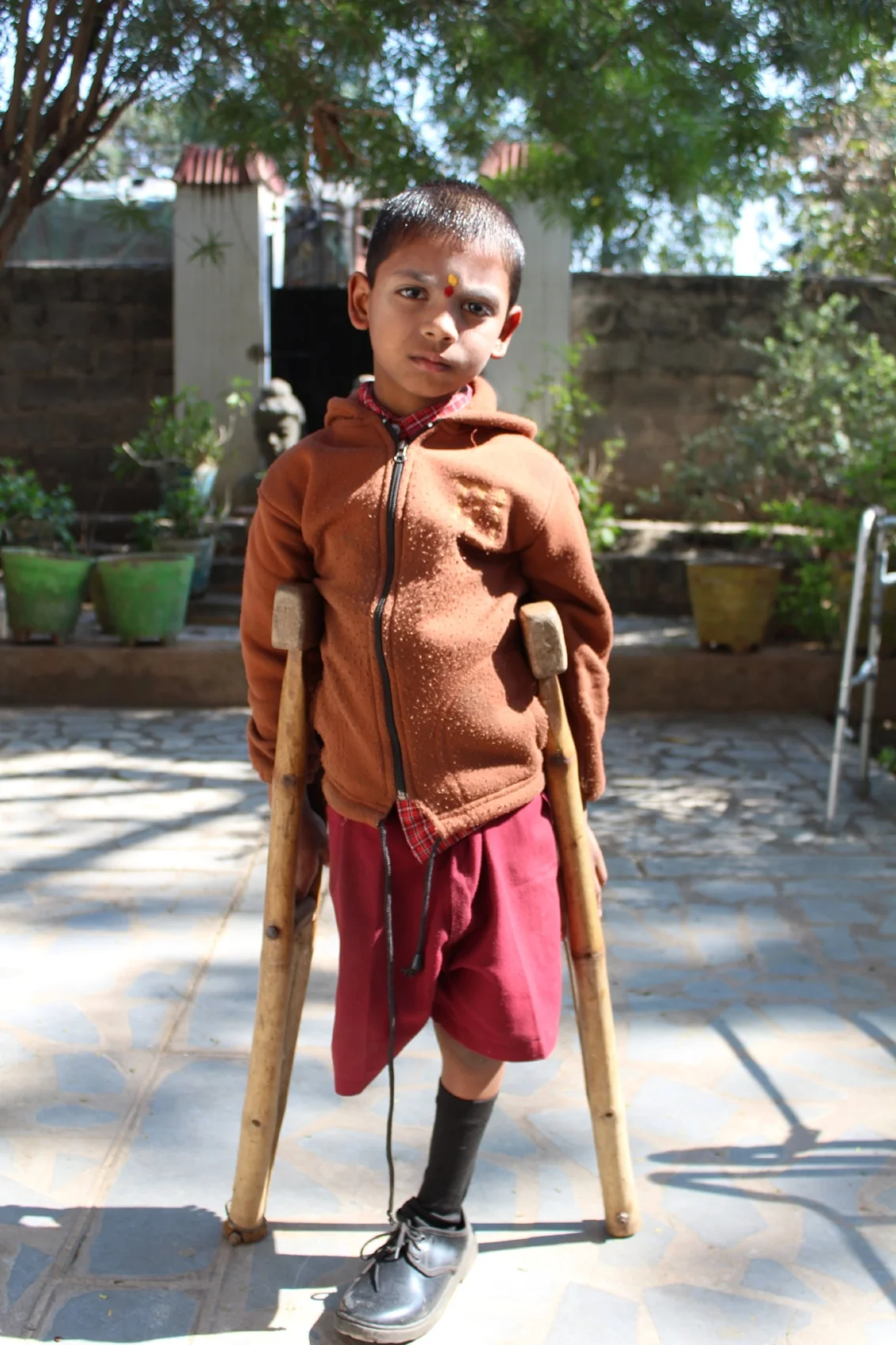 A child in need of new crutches in Hyderabad, India (Winter, 2017).