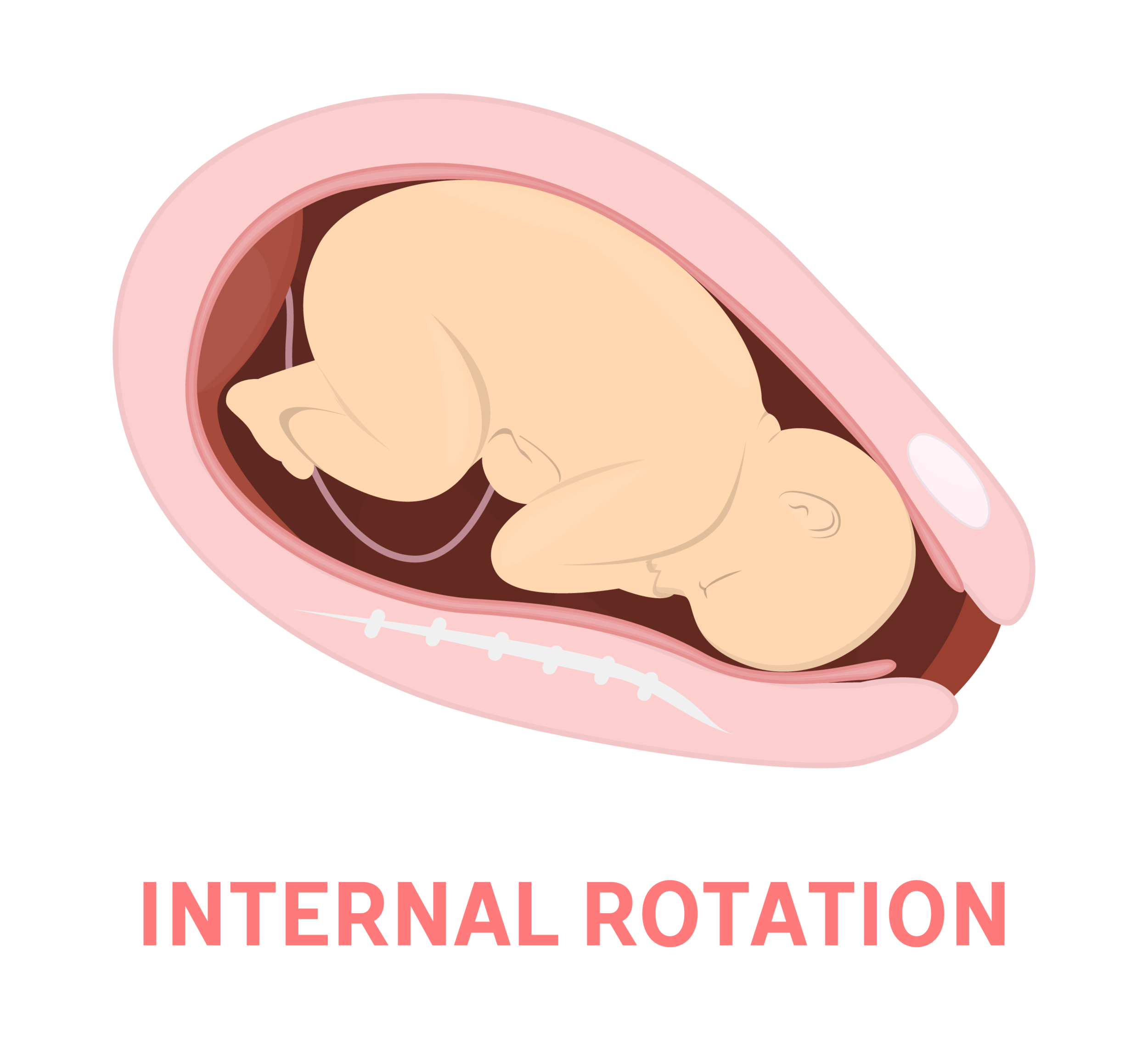 Internal Rotation.png