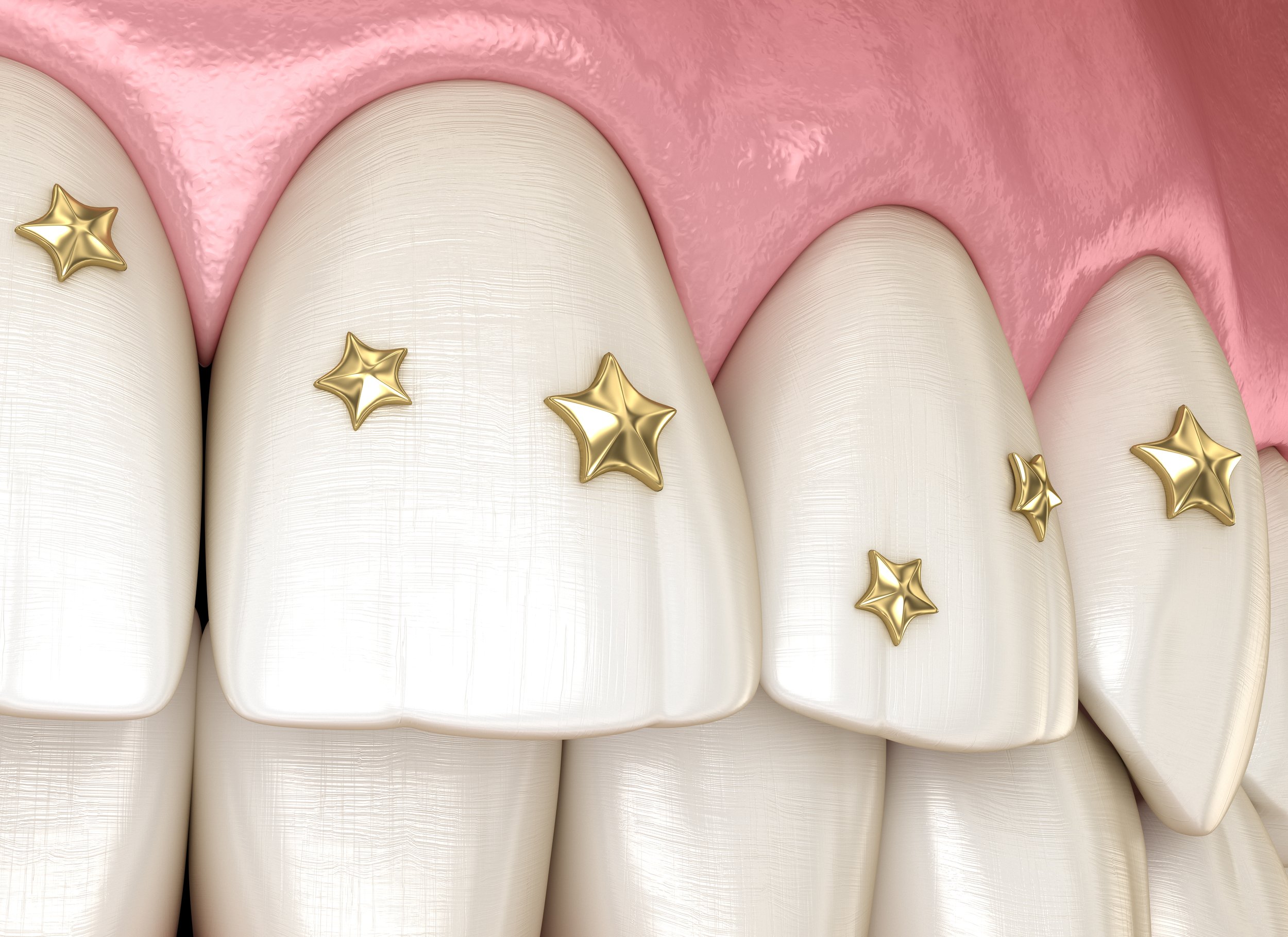 Tooth Gems and Tooth Jewelry - Westwood NJ Dentist